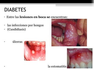 Sindrome metabolico power point b