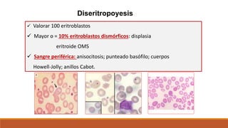 Diseritropoyesis
 Valorar 100 eritroblastos
 Mayor o = 10% eritroblastos dismórficos: displasia
eritroide OMS
 Sangre periférica: anisocitosis; punteado basófilo; cuerpos
Howell-Jolly; anillos Cabot.
 