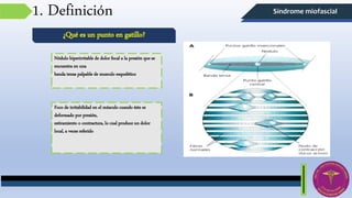 Síndrome miofascial1. Definición
Nódulo hiperirritable de dolor focal a la presión que se
encuentra en una
banda tensa palpable de musculo esquelético
¿Qué es un punto en gatillo?
Foco de irritabilidad en el músculo cuando éste es
deformado por presión,
estiramiento o contractura, lo cual produce un dolor
local, a veces referido
 