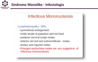 Sindrome Monolike - Linfoadenopatia Febril - Mononucleose Infecciosa - Infectologia 2019