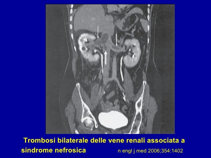 Centro di flebologichesky specializzato