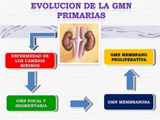 ENFERMEDAD DE LOS CAMBIOS MINIMOS GMN FOCAL Y SEGMENTARIA GMN MEMBRANOSA GMN MEMBRANO PROLIFERATIVA 