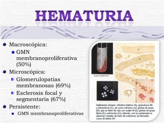 Macroscópica: GMN membranoproliferativa (50%) Microscópica: Glomerulopatias membranosas (69%) Esclerosis focal y segmentaria (67%) Persistente: GMN membranoproliferativas 