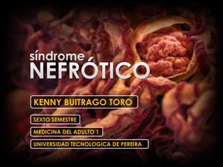 KENNY BUITRAGO TORO
SEXTO SEMESTRE

MEDICINA DEL ADULTO 1

UNIVERSIDAD TECNOLOGICA DE PEREIRA
 