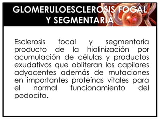 GLOMERULOESCLEROSIS FOCAL
     Y SEGMENTARIA

Esclerosis   focal   y   segmentaria
producto de la hialinización por
acumulación de células y productos
exudativos que obliteran los capilares
adyacentes además de mutaciones
en importantes proteínas vitales para
el    normal    funcionamiento     del
podocito.
 