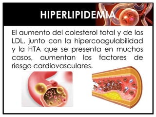 HIPERLIPIDEMIA
El aumento del colesterol total y de los
LDL, junto con la hipercoagulabilidad
y la HTA que se presenta en muchos
casos, aumentan los factores de
riesgo cardiovasculares.
 
