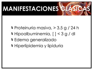 MANIFESTACIONES CLÁSICAS

  Proteinuria masiva, > 3.5 g / 24 h
  Hipoalbuminemia, [ ] < 3 g / dl
  Edema generalizado
  Hiperlipidemia y lipiduria
 