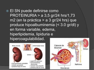    El SN puede definirse como
    PROTEINURIA > a 3,5 gr/24 hrs/1,73
    m2 (en la práctica > a 3 gr/24 hrs) que
    produce hipoalbuminemia (< 3.0 gr/dl) y
    en forma variable, edema,
    hiperlipidemia, lipiduria e
    hipercoagulabilidad.
 