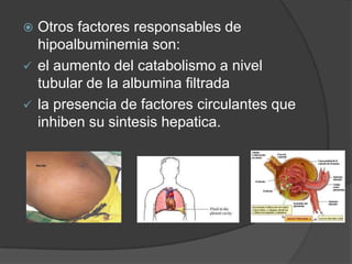  Otros factores responsables de
  hipoalbuminemia son:
 el aumento del catabolismo a nivel
  tubular de la albumina filtrada
 la presencia de factores circulantes que
  inhiben su sintesis hepatica.
 