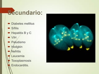 Secundario:
 Diabetes mellitus
 Sífilis
 Hepatitis B y C
 VIH
 Paludismo
 Hodgkin
 Nefritis
 Leucemia
 Toxoplasmosis
 Endocarditis.
 