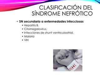 CLASIFICACIÓN DEL
SÍNDROME NEFRÓTICO
• SN secundario a enfermedades infecciosas
• Hepatitis B.
• Citomegalovirus,
• Infecciones de shunt ventriculoatrial,
• Malaria
• VIH
 