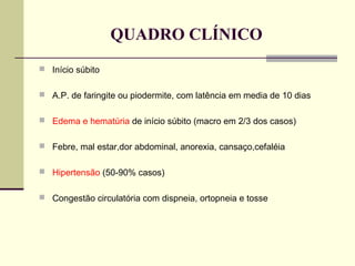 QUADRO CLÍNICO
 Início súbito
 A.P. de faringite ou piodermite, com latência em media de 10 dias
 Edema e hematúria de início súbito (macro em 2/3 dos casos)
 Febre, mal estar,dor abdominal, anorexia, cansaço,cefaléia
 Hipertensão (50-90% casos)
 Congestão circulatória com dispneia, ortopneia e tosse

 