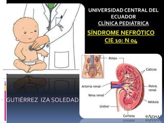 SÍNDROME NEFRÓTICO
CIE 10: N 04
UNIVERSIDAD CENTRAL DEL
ECUADOR
CLÍNICA PEDIÁTRICA
• GUTIÉRREZ IZA SOLEDAD
 