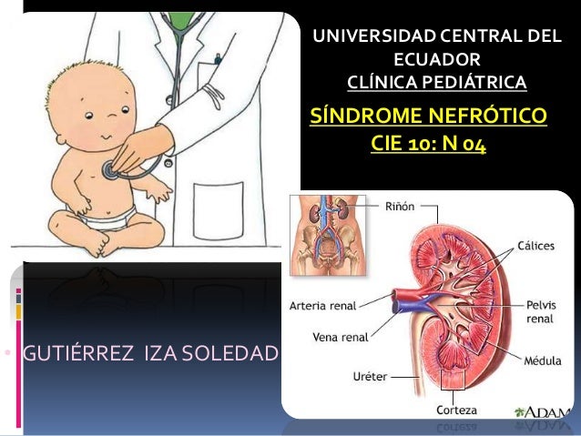 Sindrome nefrótico en Pediatria