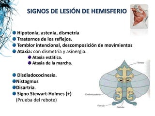 SIGNOS DE LESIÓN DE HEMISFERIO


Hipotonía, astenia, dismetría
Trastornos de los reflejos.
Temblor intencional, descomposición de movimientos
Ataxia: con dismetría y asinergia.
       Ataxia estática.
       Ataxia de la marcha.

 Disdiadococinesia.
Nistagmus
Disartria.
 Signo Stewart-Holmes (+)
(Prueba del rebote)
 