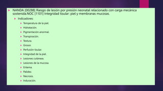 NANDA [00288] Riesgo de lesión por presión neonatal relacionado con carga mecánica
sostenida.NOC [1101] Integridad tisular: piel y membranas mucosas.
 Indicadores:
 Temperatura de la piel.
 Hidratación.
 Pigmentación anormal.
 Transpiración.
 Textura.
 Grosor.
 Perfusión tisular.
 Integridad de la piel.
 Lesiones cutáneas.
 Lesiones de la mucosa.
 Eritema.
 Palidez.
 Necrosis.
 Induración.
 