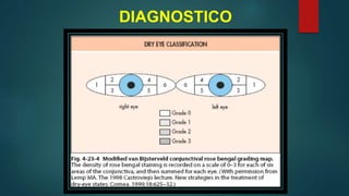 DIAGNOSTICO
 