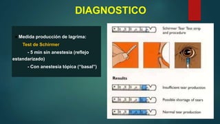 DIAGNOSTICO
● Medida producción de lagrima:
Test de Schirmer
- 5 min sin anestesia (reflejo
estandarizado)
- Con anestesia tópica (“basal”)
 