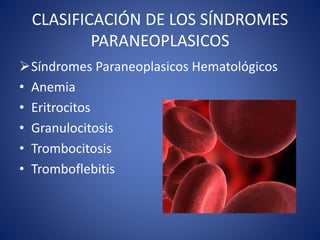 CLASIFICACIÓN DE LOS SÍNDROMES
PARANEOPLASICOS
Síndromes Paraneoplasicos Hematológicos
• Anemia
• Eritrocitos
• Granulocitosis
• Trombocitosis
• Tromboflebitis
 