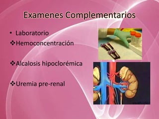 Examenes Complementarios
• Laboratorio
Hemoconcentración

Alcalosis hipoclorémica

Uremia pre-renal
 