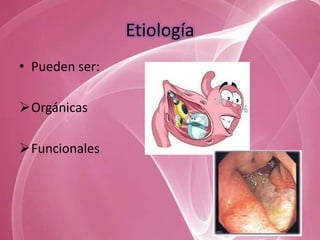 Etiología
• Pueden ser:

Orgánicas

Funcionales
 