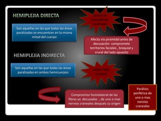HEMIPLEJIA INDIRECTA
Lesión de
hemisferios
cerebrales
Afecta vía piramidal antes de
decusación compromete
territorios faciales , braquial y
crural del lado opuesto
Son aquellas en las que todas las áreas
paralizadas en ambos hemicuerpos
Lesión tallo
cerebral
Compromiso homolateral de las
fibras ya decusadas , de uno o mas
nervios craneales después su origen
Parálisis
periférica de
uno o mas
nervios
craneales
Son aquellas en las que todas las áreas
paralizadas se encuentran en la misma
mitad del cuerpo
 