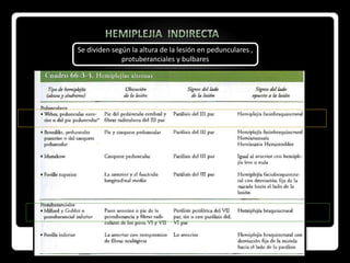 Se dividen según la altura de la lesión en pedunculares ,
protuberanciales y bulbares
 