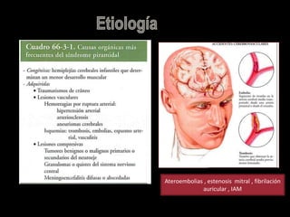 Ateroembolias , estenosis mitral , fibrilación
auricular , IAM
 