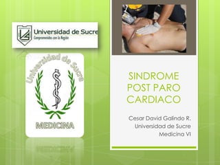 SINDROME POST PARO CARDIACO Cesar David Galindo R. Universidad de Sucre Medicina VI 