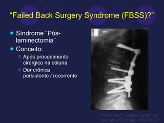 “ Failed Back Surgery Syndrome (FBSS)?” Síndrome “Pós-laminectomia” Conceito: Após procedimento cirúrgico na coluna Dor crônica persistente / recorrente Failed Back Surgery Syndrome Marcelo B Tournier - HCFMUSP 