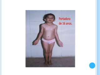 Sindromes cromosomicos