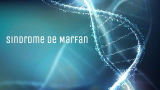 Sindrome de Marfan
 