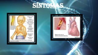 Síntomas
 