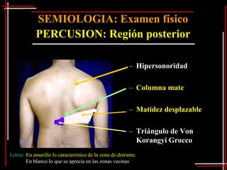 SEMIOLOGIA: Examen físico
            PERCUSION: Región posterior

                                                        – Hipersonoridad

                                                        – Columna mate

                                                        – Matidez desplazable

                                                        – Triángulo de Von
                                                          Korangyi Grocco
Letras: En amarillo lo característico de la zona de derrame.
        En blanco lo que se aprecia en las zonas vecinas
 