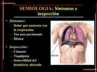 SEMIOLOGIA: Síntomas e
              inspección
• Síntomas:
  – Dolor que aumenta con   I
                            I
    la respiración.
                            n
  – Tos seca persistente
  – Disnea

• Inspección:
  – Cianosis
  – Taquipnea
  – Inmovilidad del
    hemitórax afectado
 