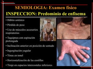 SEMIOLOGIA: Examen físico
INSPECCION: Predominio de enfisema
• Hábito asténico
• Pérdida de peso
• Uso de músculos accesorios
respiratorios
• Taquipnea con espiración
prolongada
• Inclinación anterior en posición de sentado
• Ingurgitación yugular
• Tórax en tonel
• Horizontalización de las costillas
• Tiraje en espacios intercostales inferiores
 
