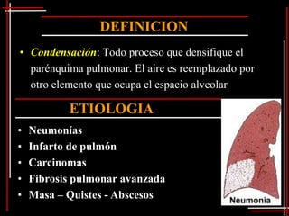 DEFINICION
• Condensación: Todo proceso que densifique el
  parénquima pulmonar. El aire es reemplazado por
  otro elemento que ocupa el espacio alveolar

           ETIOLOGIA
•   Neumonías
•   Infarto de pulmón
•   Carcinomas
•   Fibrosis pulmonar avanzada
•   Masa – Quistes - Abscesos
 