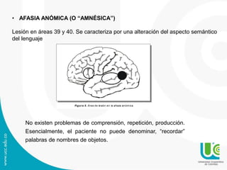 • AFASIA ANÓMICA (O “AMNÉSICA”)
Lesión en áreas 39 y 40. Se caracteriza por una alteración del aspecto semántico
del lenguaje
Figura 5. Área de lesión en la afasia anóm ica.
No existen problemas de comprensión, repetición, producción.
Esencialmente, el paciente no puede denominar, “recordar”
palabras de nombres de objetos.
 