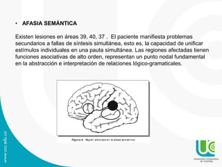 • AFASIA SEMÁNTICA
Existen lesiones en áreas 39, 40, 37 . El paciente manifiesta problemas
secundarios a fallas de síntesis simultánea, esto es, la capacidad de unificar
estímulos individuales en una pauta simultánea. Las regiones afectadas tienen
funciones asociativas de alto orden, representan un punto nodal fundamental
en la abstracción e interpretación de relaciones lógico-gramaticales.
Figura 6. Región afect ada en la afasia sem ánt ica.
 