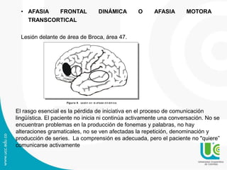 • AFASIA FRONTAL DINÁMICA O AFASIA MOTORA
TRANSCORTICAL
Lesión delante de área de Broca, área 47.
Figura 9. Lesión en la afasia dinám ica.
El rasgo esencial es la pérdida de iniciativa en el proceso de comunicación
lingüística. El paciente no inicia ni continúa activamente una conversación. No se
encuentran problemas en la producción de fonemas y palabras, no hay
alteraciones gramaticales, no se ven afectadas la repetición, denominación y
producción de series. La comprensión es adecuada, pero el paciente no "quiere”
comunicarse activamente
 