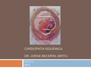 CARDIOPATIA ISQUEMICA.

DR. JORGE BECERRIL BRITO-
U.A.C.J.
2011.
 