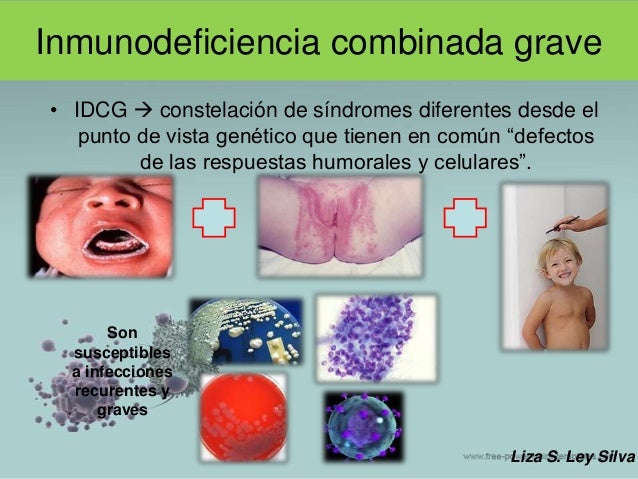 Sindromes de inmunodeficiencia