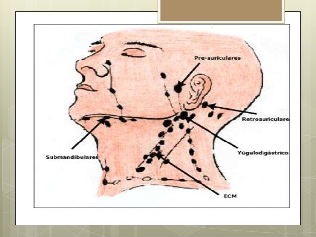 Las sensaciones desagradables en las manos a la osteocondrosis