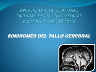 SINDROMES DEL TALLO CEREBRAL
 