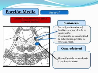 lateral
Ipsilateral
Arteria circunferencial corta
(tronco basilar)
• Alteración de la termoalgesia
(t. espinotalamico).
Contralateral
• Ataxia ( pedúnculo c m)
• Parálisis de músculos de la
masticación
• Disminución de sensibilidad
de la hemicara, pérdida de
reflejo corneal.
 