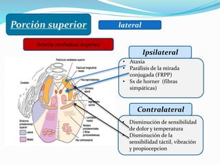 lateral
Ipsilateral
Arteria cerebelosa superior
• Disminución de sensibilidad
de dolor y temperatura
• Disminución de la
sensibilidad táctil, vibración
y propiocepcion
Contralateral
• Ataxia
• Parálisis de la mirada
conjugada (FRPP)
• Sx de horner (fibras
simpáticas)
 