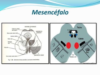 Mesencéfalo
 