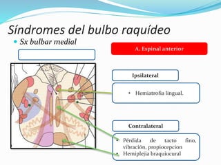 Síndromes del bulbo raquídeo
 Sx bulbar medial
Ipsilateral
Contralateral
• Hemiatrofia lingual.
• Pérdida de tacto fino,
vibración, propiocepcion
• Hemiplejia braquiocural
A. Espinal anterior
 