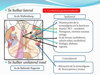  Sx bulbar lateral
 Sx bulbar unilateral total
Ipsilateral
• Disminución de la
termoalgesia en la hemicara
• Ataxia ( PCI – cerebelo)
• Nistagmos, vómitos nauseas
vértigo
• Sx de horner (anhidrosis,
miosis rubor, enoftalmo)
• Disfagia, disfonia
• Ageusia
Contralateral
• Alteración de la termoalgesia
de brazo pierna y troncoSx de Babinski-Nageotte
Sx de Wallemberg
A. Cerebelosa posteroinferior
 