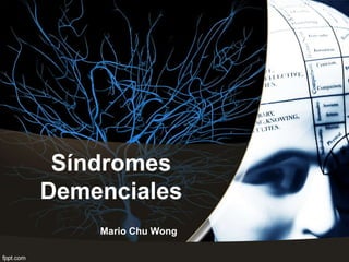 Síndromes
Demenciales
Mario Chu Wong
 